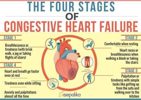 Uk Cardiologist Stages Of Congestive Heart Failure Stages Of