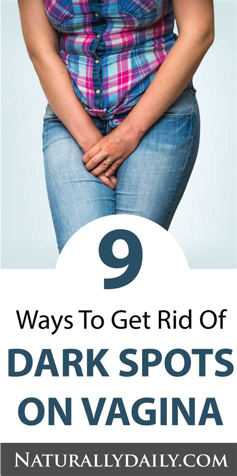 How To Get Rid Of Dark Spots On Your Vagina My XXX Hot Girl