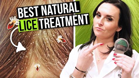 How To Get Rid Of Lice And Eggs Fast At Home Best Natural Treatment