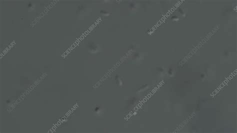 E Coli Bacteria Microscopy Stock Video Clip K0069603 Science