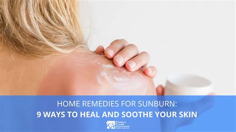 Home Remedies For Sunburn 9 Ways To Heal And Soothe Your Skin