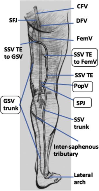 Lack Of Symmetry In The Major Lower Limb Veins Journal Of Vascular