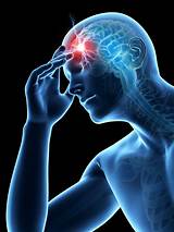 Frontal Headache Treatment