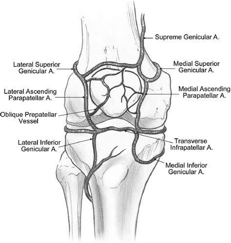 Patella Fractures And Injuries To The Knee Extensor Mechanism