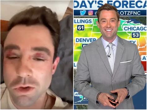 Fox News Weatherman Who Claims He Was Beaten On New York Subway Says