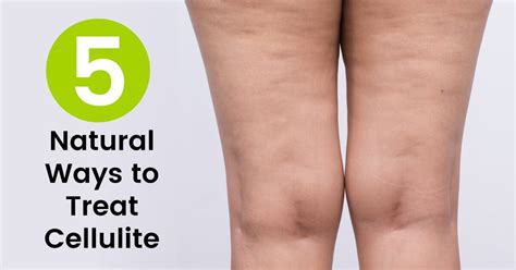 How To Get Rid Of Cellulite 5 Natural Treatments Dr Axe