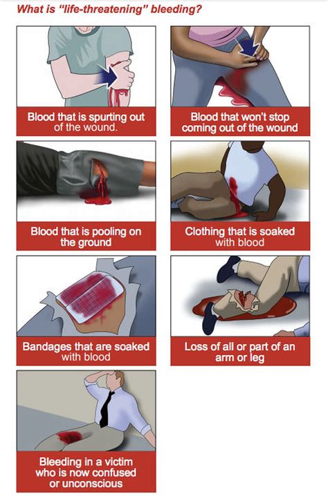 Lessons From A Stop The Bleed Class