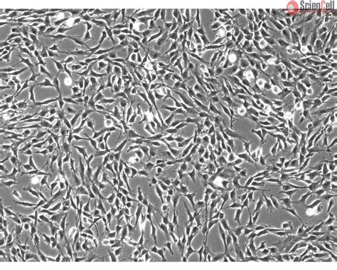 Human Oral Fibroblasts Horf Sciencell Research Laboratories