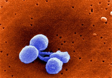 Free Picture Scanning Electron Micrograph Streptococcus Pneumoniae