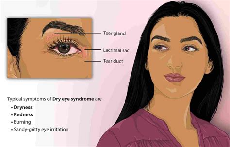Burning Eyes Causes Treatment And Home Remedies