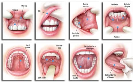 Doctors need to know what stage your oral cancer is in to help decide what treatment to recommend. To Check Your Chances of Oral Cancer, Read This - Dental ...