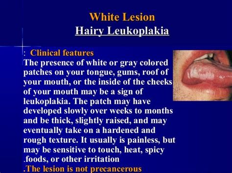 White Lesions