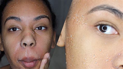 How To Get Rid Of Dry Skin Literally Rub All The Dead Skin Off Your
