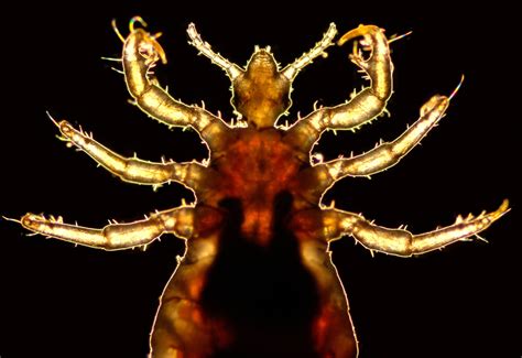 Free Picture Magnified Male Body Louse Pediculus Humanus Corporis