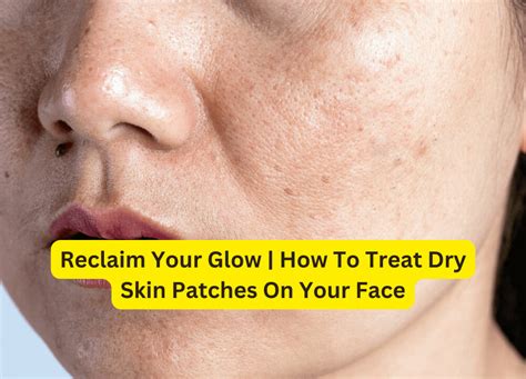 Reclaim Your Glow How To Treat Dry Skin Patches On Your Face