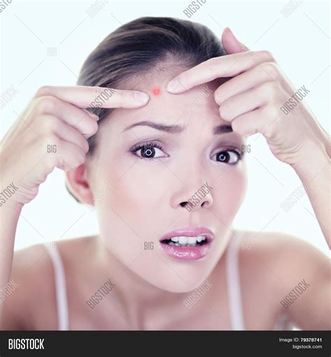 Acne Pimple Skin Image And Photo Free Trial Bigstock