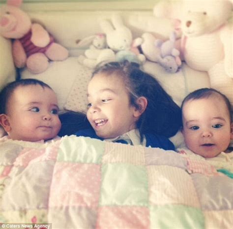 Siamese Twins Rosie And Ruby Formosa Still Share Something Special Daily Mail Online
