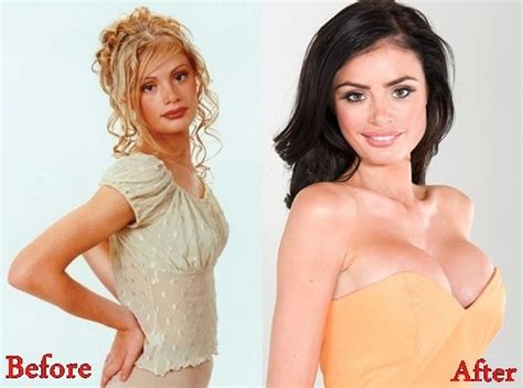 Chloe Sims Breasts Implants Plastic Surgery Before And After Photos 2018 Plastic Surgery