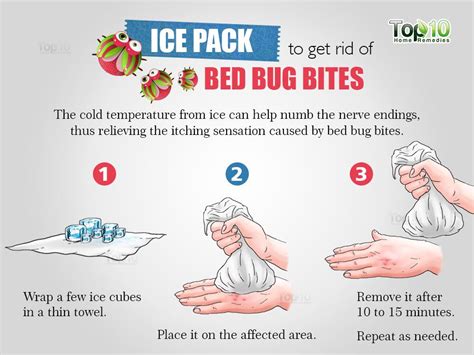 How To Cure Bed Bug Bites Home Remedy Grizzbye