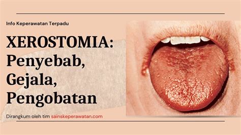 Xerostomia Patofisiologi Diagnosis Penatalaksanaan Alomedika The Best Porn Website