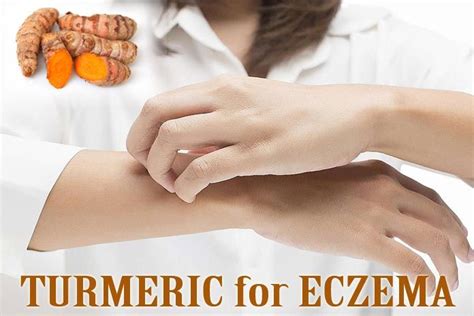 How To Use Turmeric For Eczema And Itching Effectively Eczema
