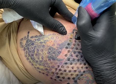 Tatt Away Changing The Laser Tattoo Removal Industry Forever Tatt Away