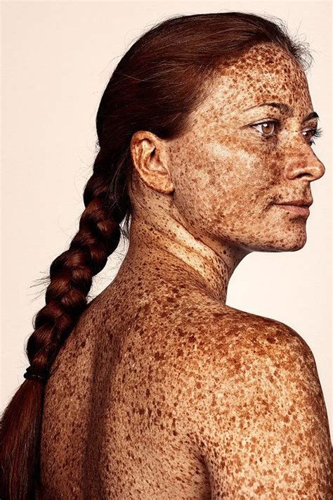 These Portraits Celebrate The Joy Of Having Freckles Beautiful Freckles Portrait Freckles