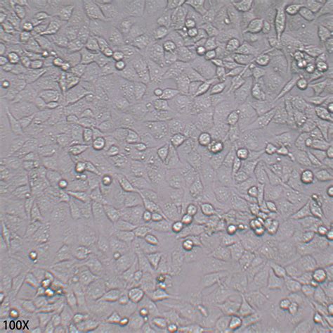 Mda Mb Organoid