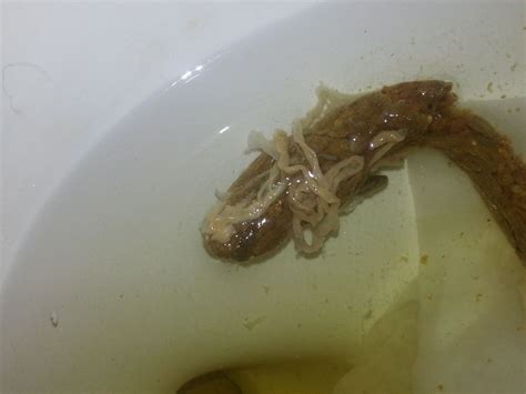 Parasites may enter the system through consumption of infected water and food. 20131125 100457 On CureZone Image Gallery