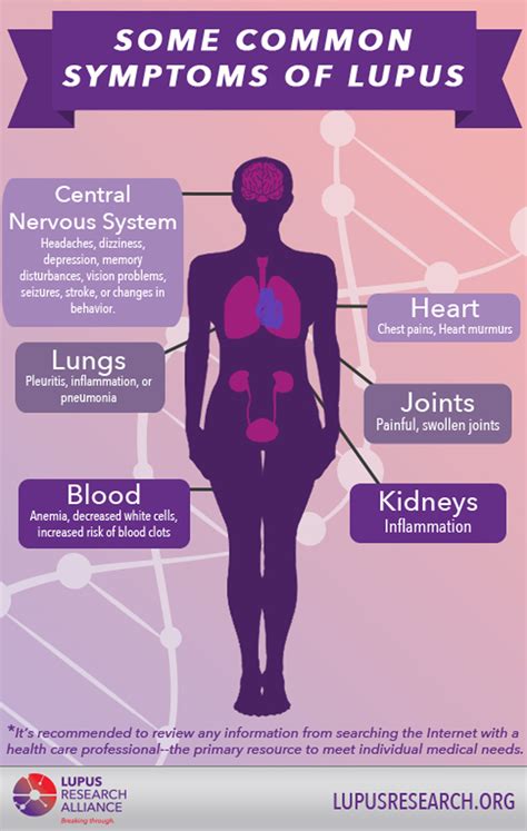 Although There Are Many Symptoms Of Lupus Here Are Some Common Ones