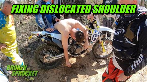 Fixing Dislocated Shoulder After Dirt Bike Crash Te300 Youtube