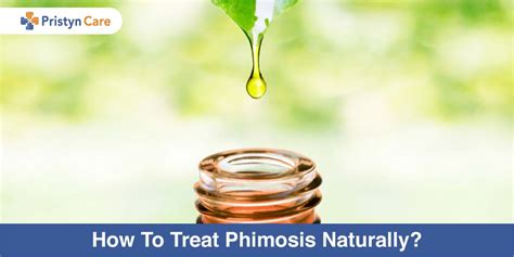 How To Treat Phimosis Naturally Pristyn Care