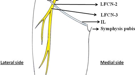 Femoral Nerve Injury Injury Choices