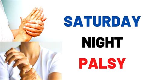 Saturday Night Palsy Wrist Drop Causes Symptoms Treatment Of Radial