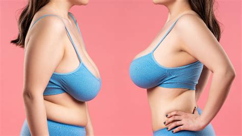 Signs Of Healthy Breasts Here S When To Worry Healthshots