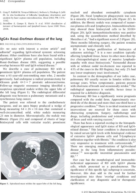 Igg4 Rosaidorfman Disease Of The Lung Roberts 2010