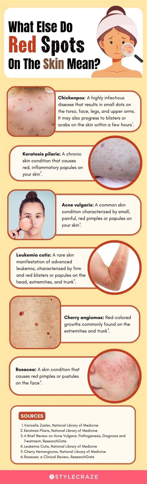 6 Natural Ways To Treat Red Spots On Skin And Prevention Tips