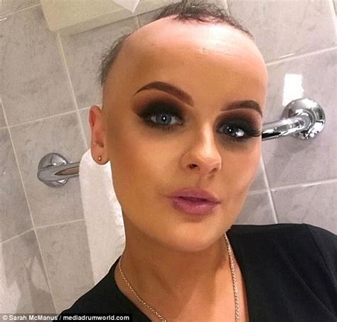 Wishaw Woman Born With Alopecia Embraces Her Baldness Daily Mail Online
