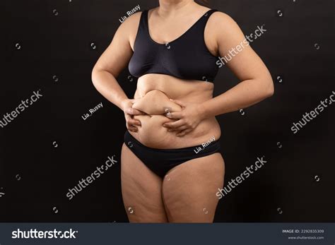 2 055 Nude Obesity Images Stock Photos Vectors Shutterstock