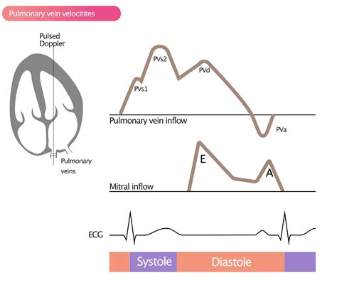 Assessment Of Diastolic Function By Echocardiography Ecg And Echo