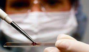 Колостома какая диета Колостома - что это такое, показания к наложению стомы при раке Колостома - что это такое, показания к наложению стомы при раке Колостома какая диета