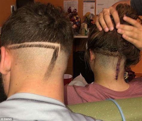 Brother Gets His Hair Cut In The Style Of A 10 Inch Scar To Match His