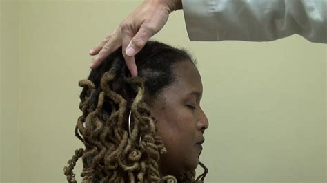 Maybe you would like to learn more about one of these? Bald Black Woman Hair Loss Surgery Treatment Before After ...