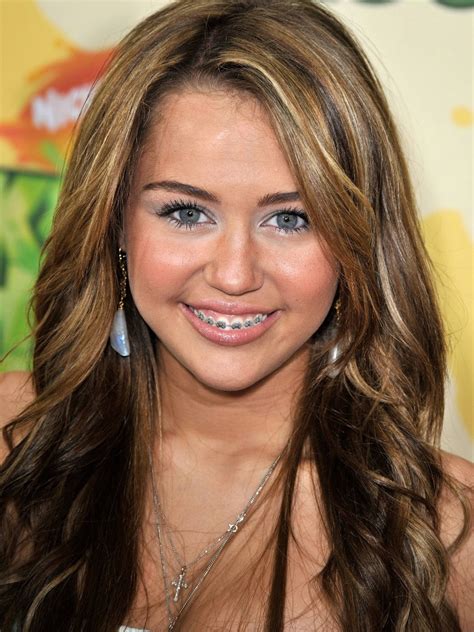 Listed below are brief biographies of famous individuals that suffer from cerebral palsy. Celebrities with Braces (with Pictures) | New Health Advisor