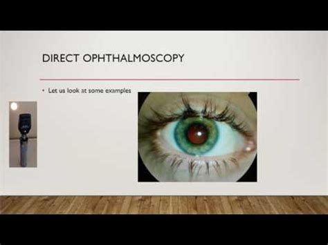 How To Do Fundoscopy A Direct Ophthalmoscopy Osce Youtube