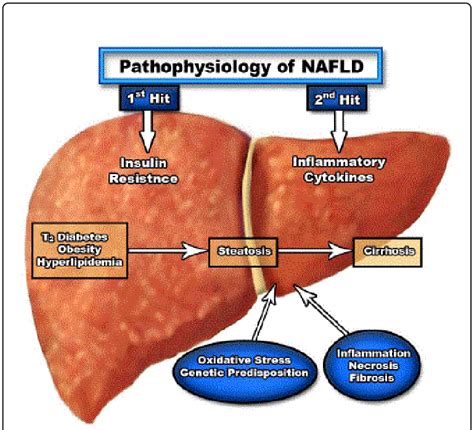 Pathophysiology Of Non Alcoholic Fatty Liver Disease Nafld Two