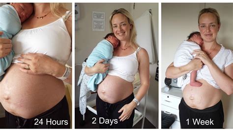 Mum Tums Dont Just Bounce Back Mother Posts Encouraging Photos Of