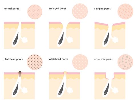 How To Shrink Pores A Complete Step By Step Guide The Yesstylist Asian Fashion Blog