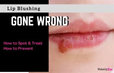 Lip Blushing Gone Wrong What To Do And How To Prevent Makeup Zee
