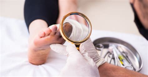 10 Reasons To See A Podiatrist The Medical Group Of South Florida